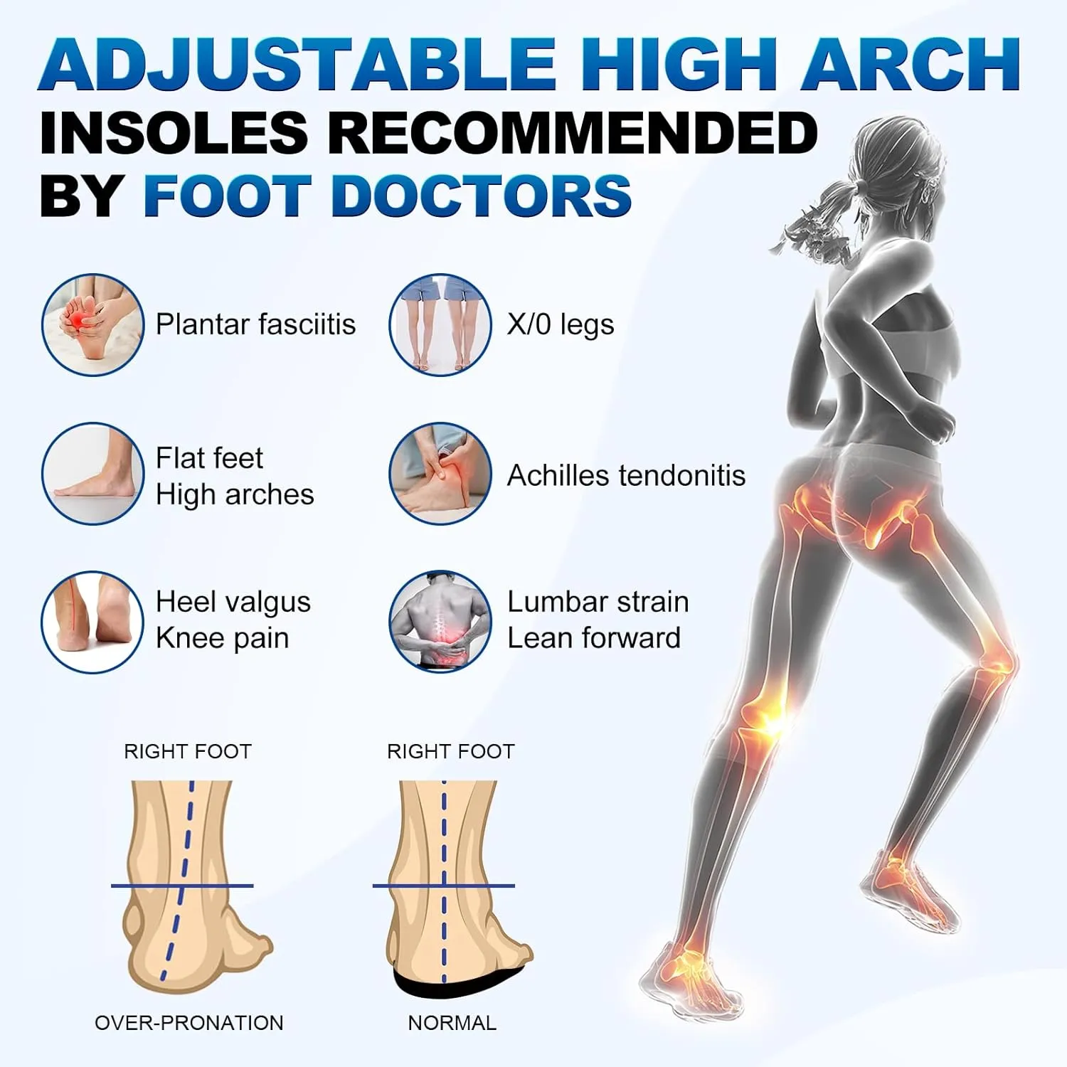3/4 Removable High Arch Support Shoe Inserts, Orthopedic Insoles for Plantar Fasciitis Relief, Standing All Day Pain Relief, Knee Pain, Over-Pronation, Shoe Insoles for Men & Women - XL(Men's10-12.5)