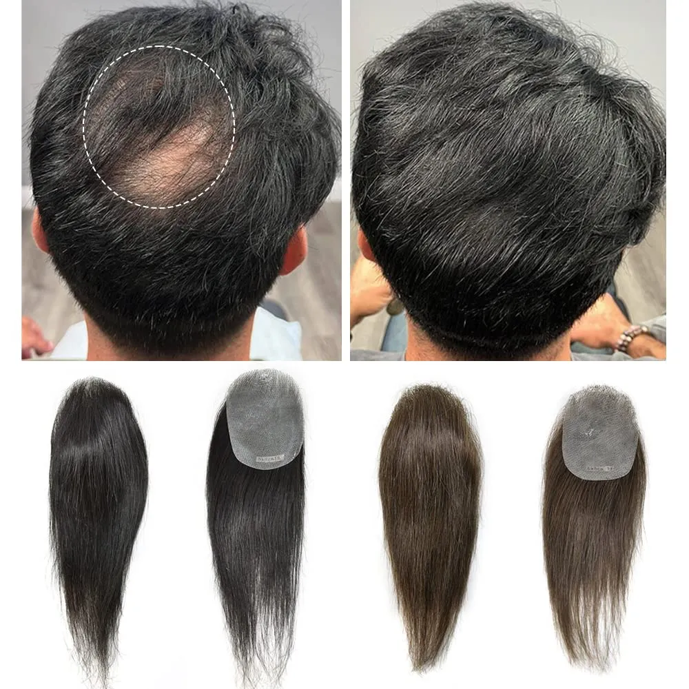 Bald Spot Hair Patch For Men V-Looped Remy Human Hair Patch For Bald Spot Natural lookimg Hair Replacement Unit Thin Skin Hair Piece for Bald Spot Hair Systems (#3 DARK BROWN, 4cm X 8cm - 14 INCH)