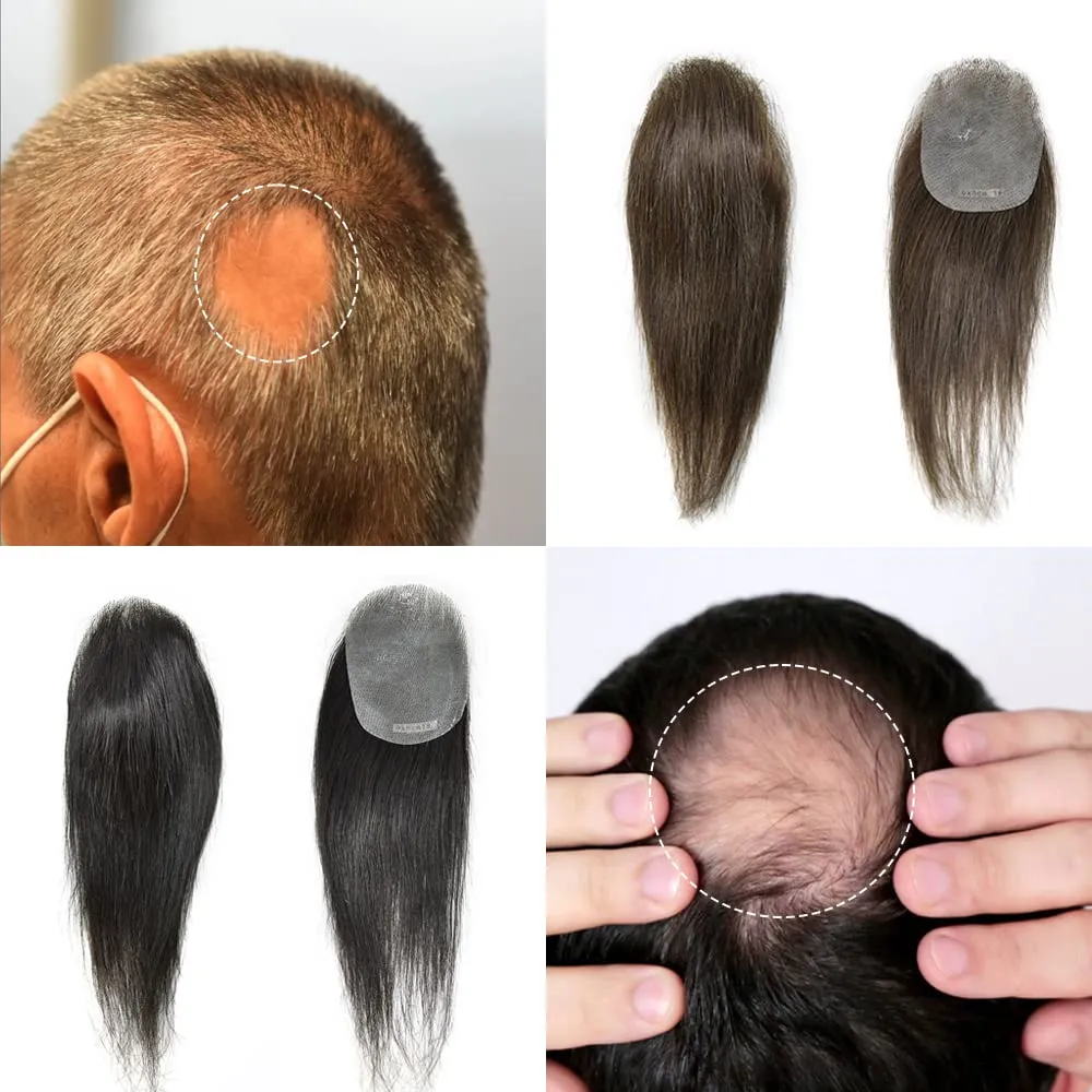 Bald Spot Hair Patch For Men V-Looped Remy Human Hair Patch For Bald Spot Natural lookimg Hair Replacement Unit Thin Skin Hair Piece for Bald Spot Hair Systems (#4 MEDIUM BROWN, 4cm X 8cm - 14 INCH)
