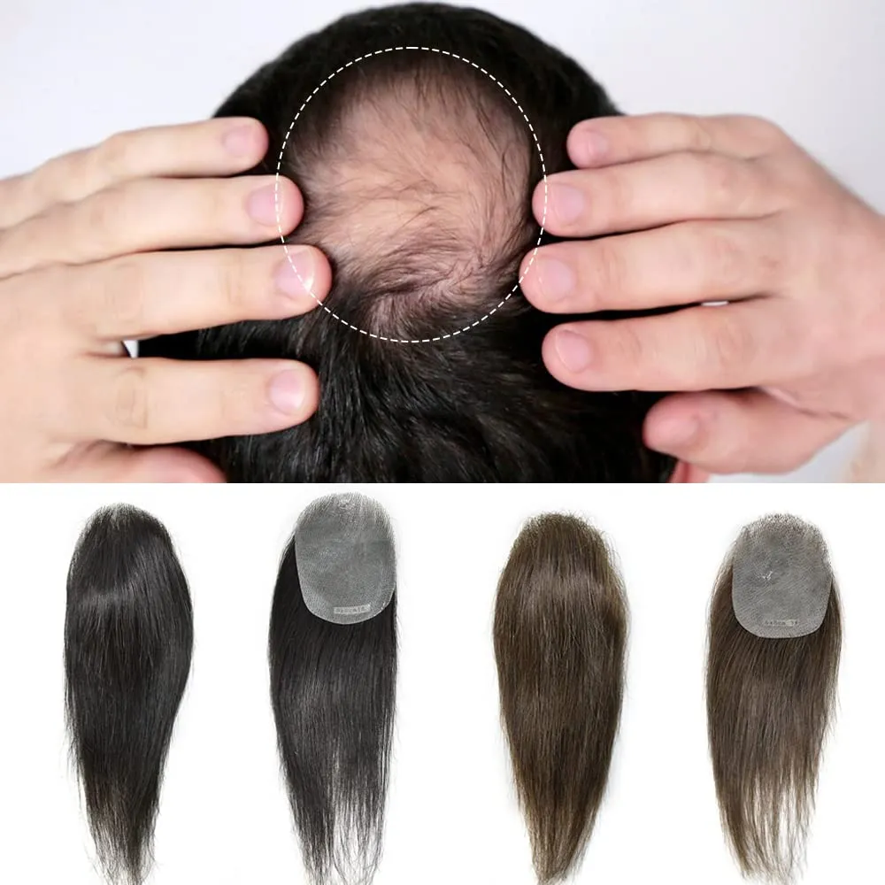 Bald Spot Hair Patch For Men V-Looped Remy Human Hair Patch For Bald Spot Natural lookimg Hair Replacement Unit Thin Skin Hair Piece for Bald Spot Hair Systems (#4 MEDIUM BROWN, 4cm X 8cm - 14 INCH)
