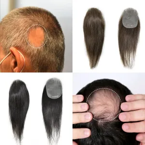 Bald Spot Hair Patch For Men V-Looped Remy Human Hair Patch For Bald Spot Natural lookimg Hair Replacement Unit Thin Skin Hair Piece for Bald Spot Hair Systems (#4 MEDIUM BROWN, 4cm X 8cm - 14 INCH)