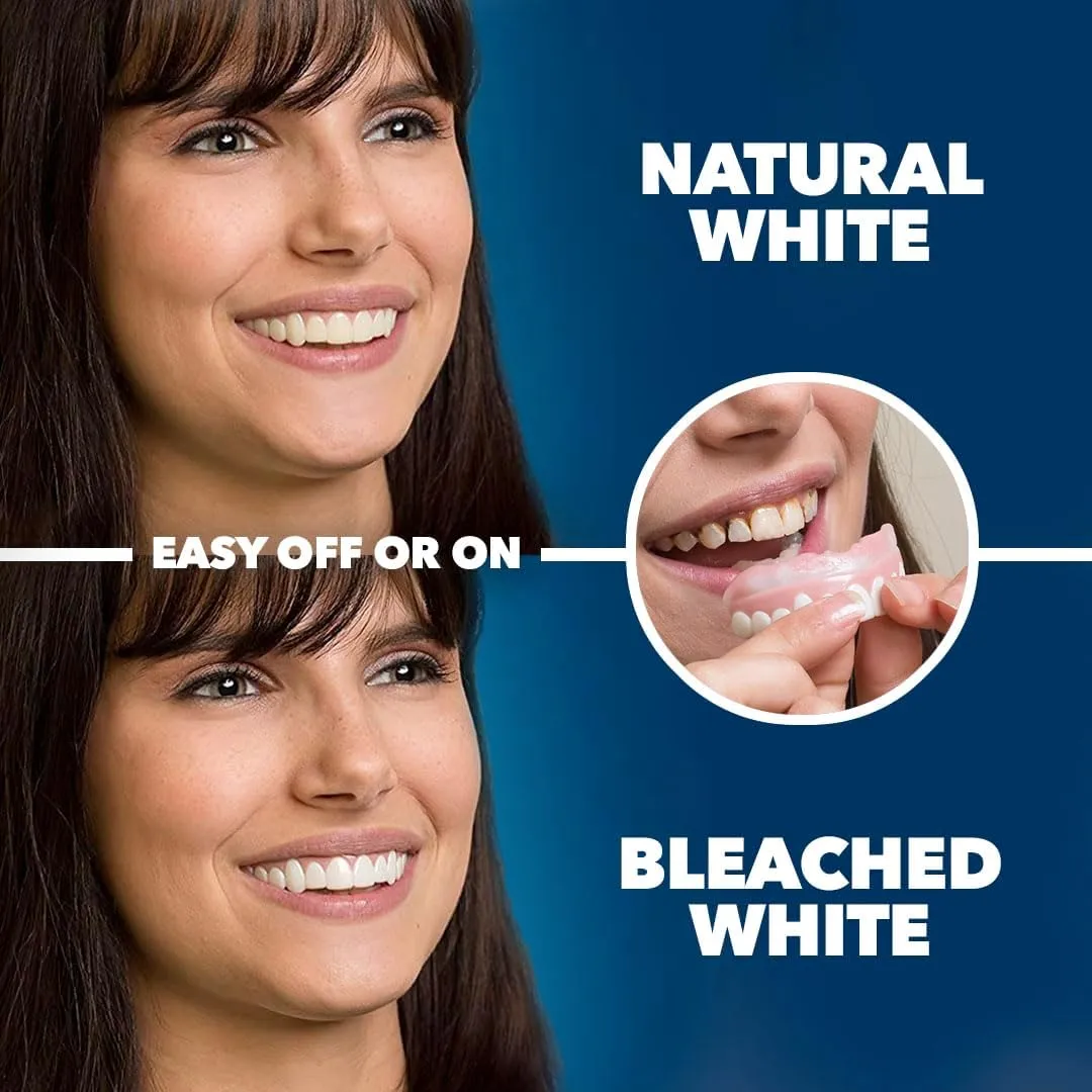 Imako Premium Cosmetic Uppers - 1 Pack - Large, Natural White - DIY Smile Makeover - Made in USA